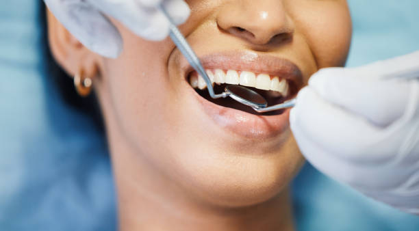 Reliable Marksville, LA Dental Services Solutions